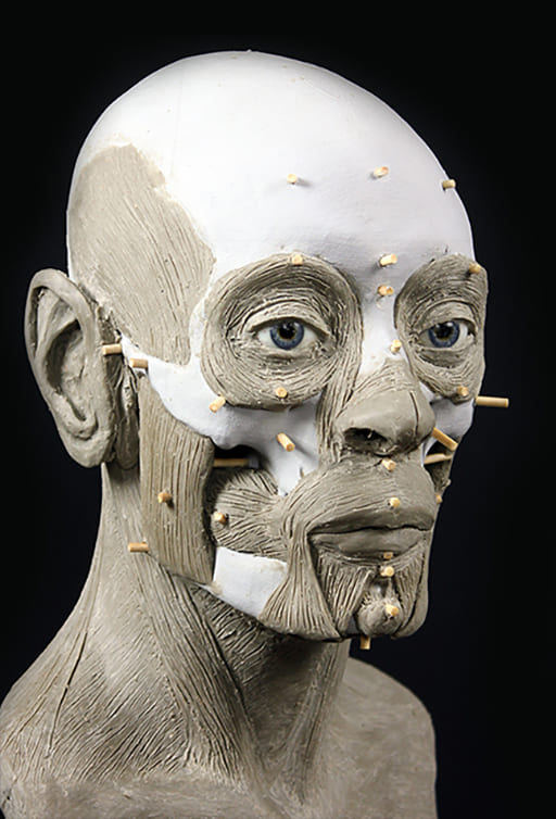 Reconstructions